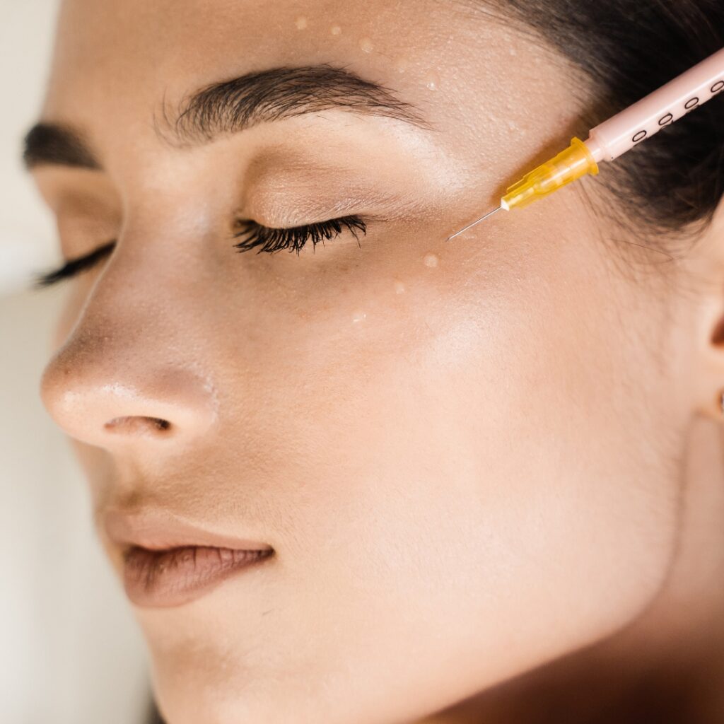 Dermal Filler in London